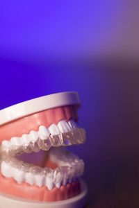 Strategies for Keeping Dentures in Trumbull CT Clean and Comfortable